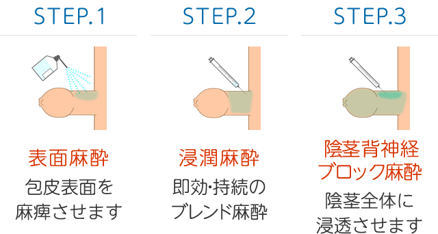 表面麻酔